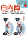 白內障 (電子書) - 圖片 1