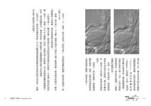 腦血管微創醫師的告白: 撐開血栓, 探見手術間錯綜複雜的人生 - 圖片 6