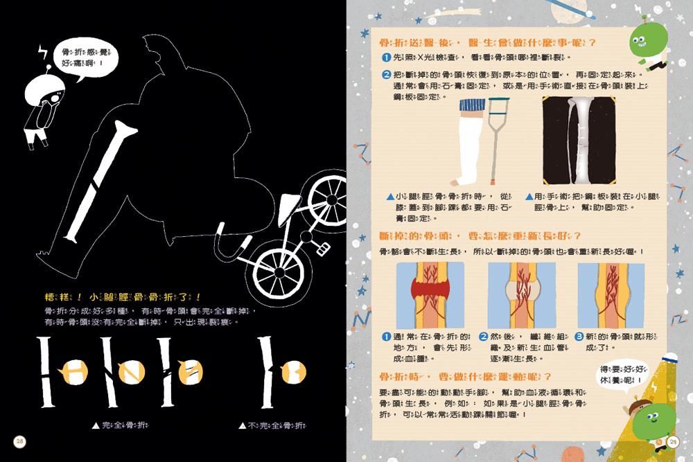 折感覺痛啊折做什麼事先照X光檢查看看骨頭哪裡斷裂② 把斷 掉的骨頭恢復原本的位置再固定起來通常會膏固定是在骨頭裝上固定骨骨折膝蓋到脚踝用石膏固定用術把鋼板裝在脛骨上幫助固定。斷掉的骨頭好?骨骼會不斷生長所以斷掉的骨也會重新長好糟糕小腿脛骨骨折了!骨折分成好多種有骨頭會斷掉有時骨頭沒有完全斷I掉只。 ①通常在骨折的地方會先形成!然後,新的骨頭就形新生血管 成了。逐漸生長。得好好骨折時,什麼運呢?要可能的動手腳幫助血液循環和骨頭生長,例如:如果是小腿ㄟˋˋ骨骨折,可以常常活動踝關節喔休養呢!完全骨折:▲不完全骨折