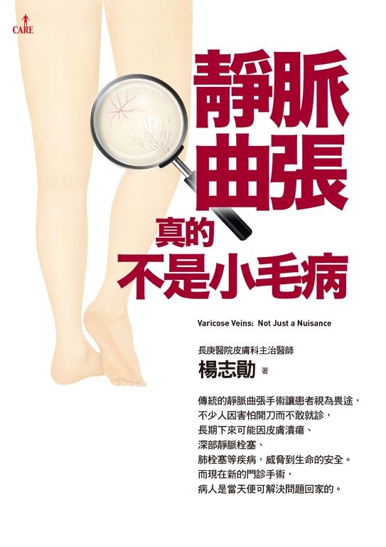 靜脈曲張,真的不是小毛病 (電子書)