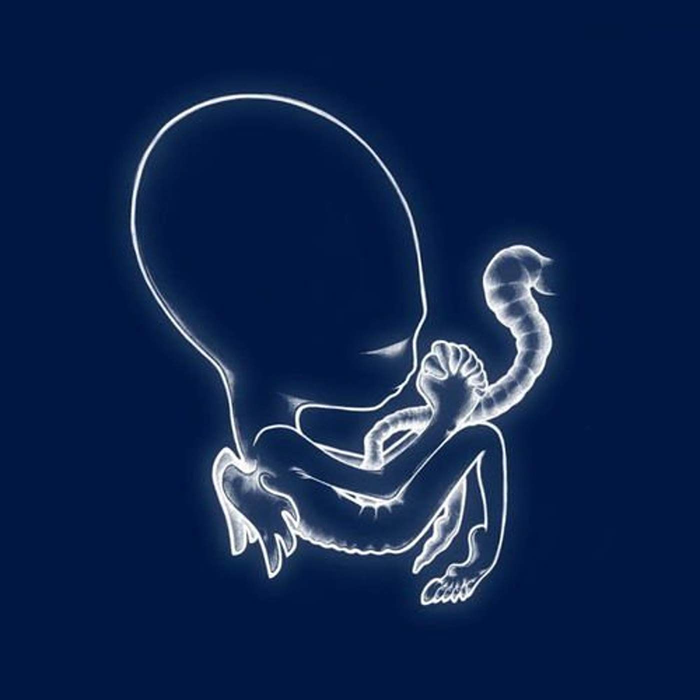 Agaetis Byrjun (2LP)
